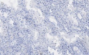 Anti-Endoglin Antibody, clone 1I15 ZooMAb Rabbit Monoclonal 