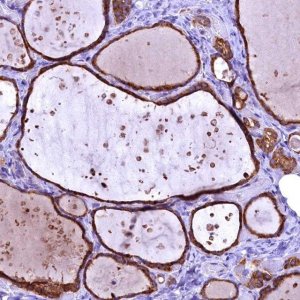 Anti-ENKD1 antibody produced in rabbit 