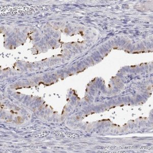 Anti-ENO4 antibody produced in rabbit 