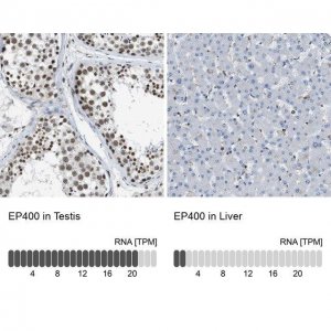 Anti-EP400 antibody produced in rabbit 