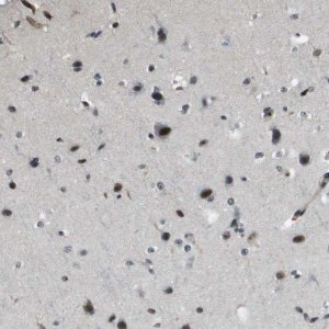 Anti-EP400 antibody produced in rabbit 