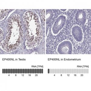 Anti-EP400NL antibody produced in rabbit 