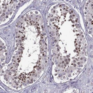 Anti-EP400NL antibody produced in rabbit 
