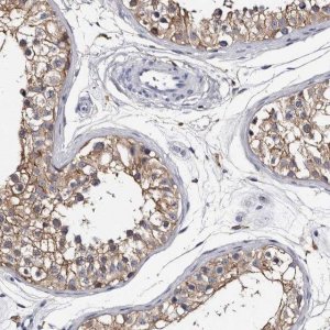 Anti-EPB41L3 antibody produced in rabbit 