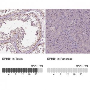 Anti-EPHB1 antibody produced in rabbit 