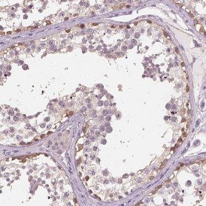 Anti-EPHB1 antibody produced in rabbit 