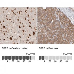 Anti-EPRS antibody produced in rabbit 