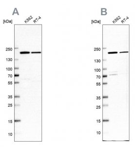 Anti-EPRS antibody produced in rabbit 