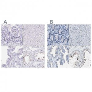 Anti-EQTN antibody produced in rabbit HPA015504-100UL