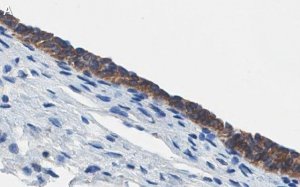Anti-ErbB2/HER-2 Antibody, clone 1B13 ZooMAb Rabbit Monoclonal 