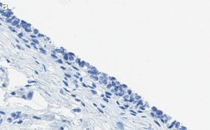 Anti-ErbB2/HER-2 Antibody, clone 1B13 ZooMAb Rabbit Monoclonal 