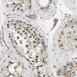 Anti-ERBB4 antibody produced in rabbit 