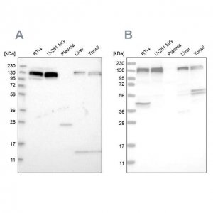 Anti-ERC1 antibody produced in rabbit 