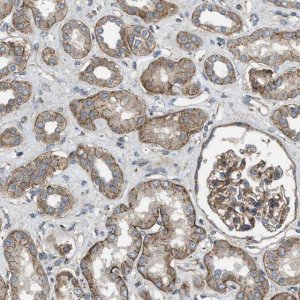 Anti-ERC1 antibody produced in rabbit 