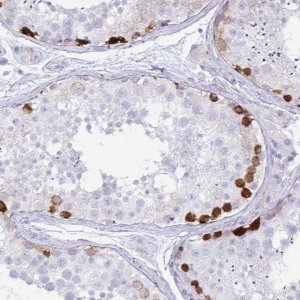 Anti-ERICH6 antibody produced in rabbit 