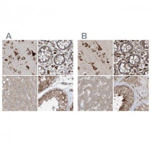 Anti-ERLEC1 antibody produced in rabbit HPA031502-100UL