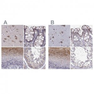 Anti-ERO1A antibody produced in rabbit 
