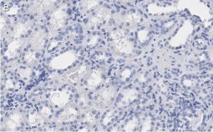 Anti-Erythropoietin Antibody, clone 6E5, ZooMAb Rabbit Monoclonal 