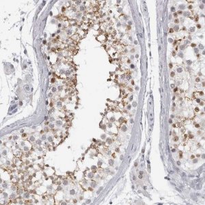 Anti-ESPN antibody produced in rabbit 