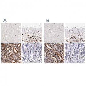 Anti-ESR1 antibody produced in rabbit 