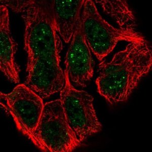 Anti-ESRP1 antibody produced in rabbit 