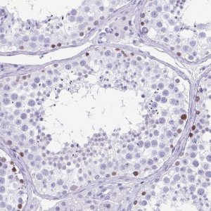 Anti-ESX1 antibody produced in rabbit 