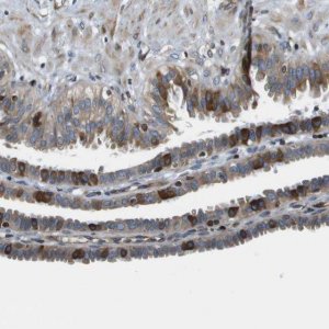 Anti-ESYT1 antibody produced in rabbit HPA016858-100UL