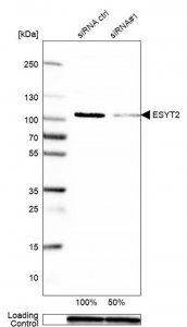 Anti-ESYT2 antibody produced in rabbit 
