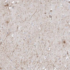 Anti-ETAA1 antibody produced in rabbit 