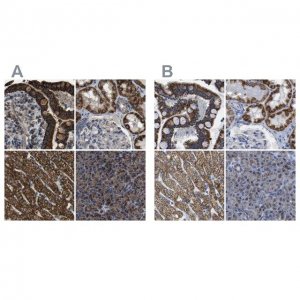 Anti-ETFA antibody produced in rabbit HPA018990-100UL