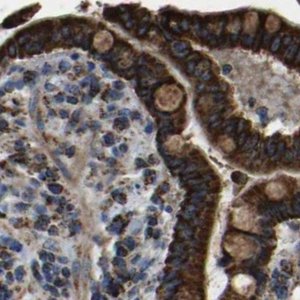 Anti-ETFA antibody produced in rabbit HPA018990-100UL
