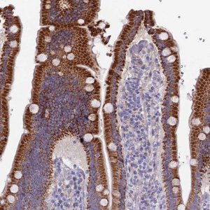 Anti-ETFDH antibody produced in rabbit 