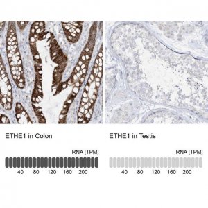 Anti-ETHE1 antibody produced in rabbit HPA028360-100UL