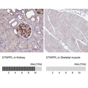 Anti-ETNPPL antibody produced in rabbit 