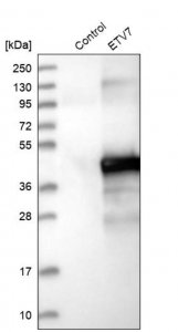 Anti-ETV7 antibody produced in rabbit 