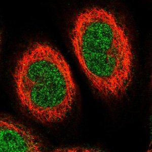 Anti-ETV7 antibody produced in rabbit 