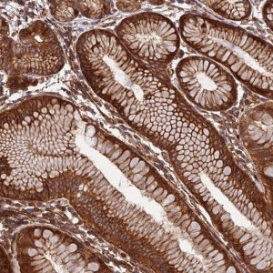 Anti-EVI5L antibody produced in rabbit 
