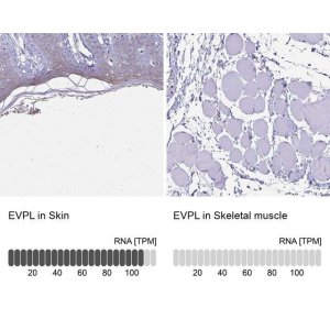 Anti-EVPL antibody produced in rabbit 