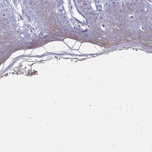 Anti-EVPL antibody produced in rabbit 