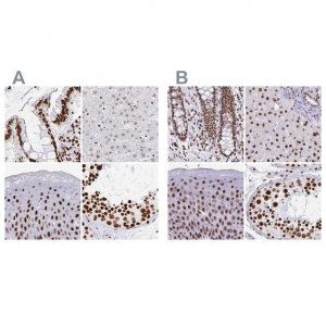 Anti-EWSR1 antibody produced in rabbit HPA051771-100UL