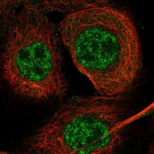 Anti-EXO5 antibody produced in rabbit 