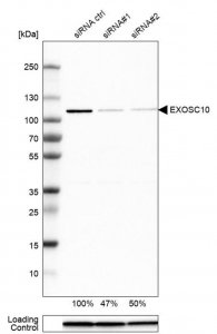 Anti-EXOSC10 antibody produced in rabbit HPA028470-100UL