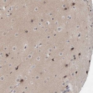 Anti-EXOSC10 antibody produced in rabbit HPA028470-100UL