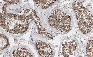 Anti-EZHIP/CXorf67 Antibody, clone 1J8 ZooMAb Rabbit Monoclonal 