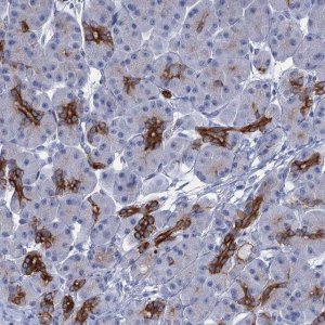 Anti-FAAP20 antibody produced in rabbit 