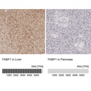 Anti-FABP1 antibody produced in rabbit 