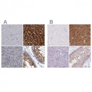 Anti-FAH antibody produced in rabbit 