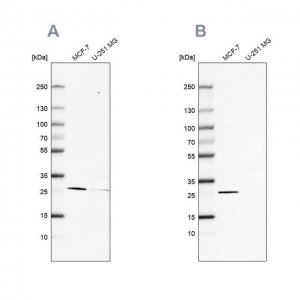 Anti-FAHD1 antibody produced in rabbit 