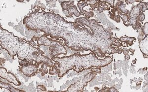 Anti-FAK Antibody, clone 1D14 ZooMAb Rabbit Monoclonal 