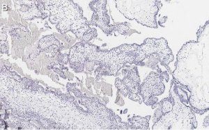 Anti-FAK Antibody, clone 1D14 ZooMAb Rabbit Monoclonal 